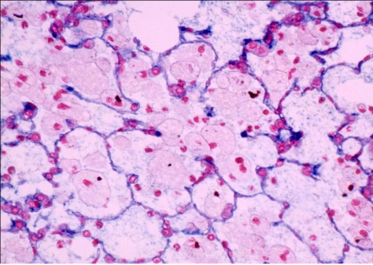 疾控中心職業衛生實驗室的顯微鏡應用